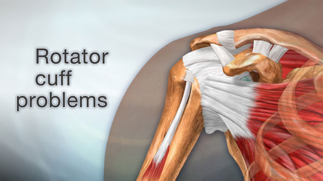 Rotator cuff problems Feeling pain in your shoulder when